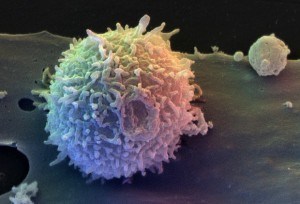 腸内フローラとTレグ