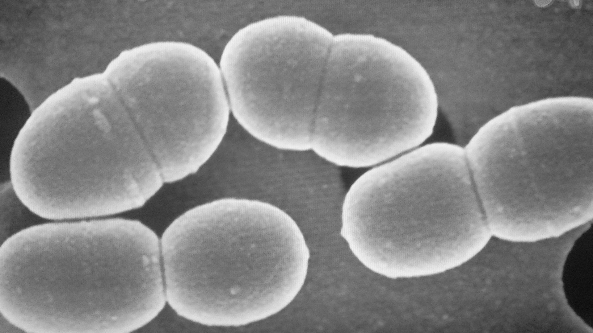 悪玉菌の増殖と活性化を抑えるＩｇＡ抗体を発見