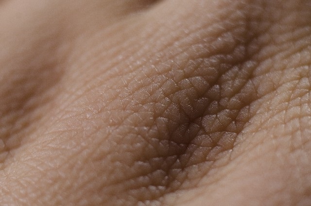 皮膚フローラが感染症を防ぐ可能性